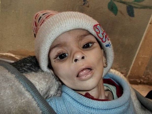敘利亞圍困小城 4萬多人面臨餓死國際搶救 | 文章內置圖片